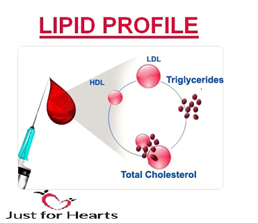 Lipid Profile