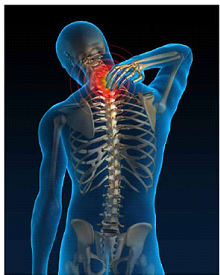 Spondylosis